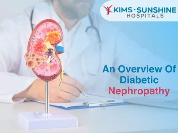 Best Nephrology Hospital In Hyderabad