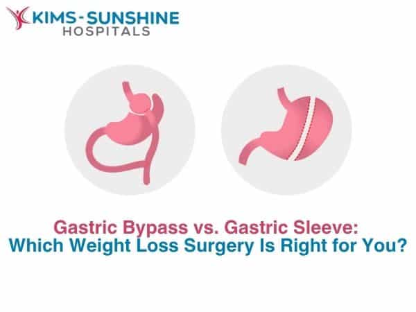 Gastric Bypass vs. Gastric Sleeve: Which Weight Loss Surgery Is Right for You