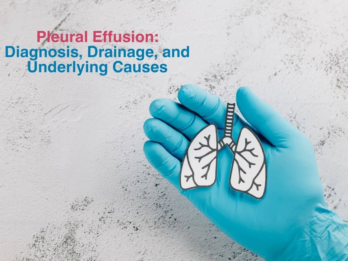 Pleural Effusion: Diagnosis, Drainage, and Underlying Causes