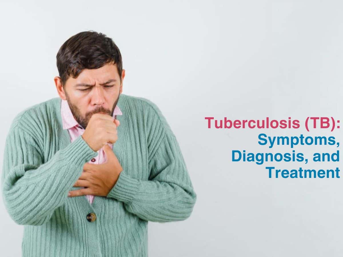 Tuberculosis