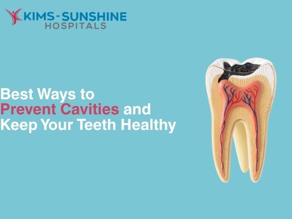 Best Ways to Prevent Cavities and Keep your Teeth Healthy