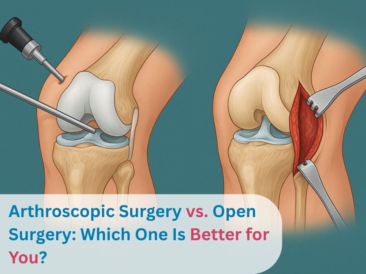 Arthroscopic Surgery vs. Open Surgery_ Which One Is Better for You