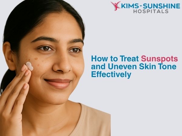 How to Treat Sunspots and Uneven Skin Tone Effectively