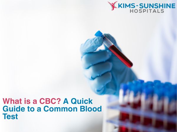 What is a CBC? A Quick Guide to a Common Blood Test