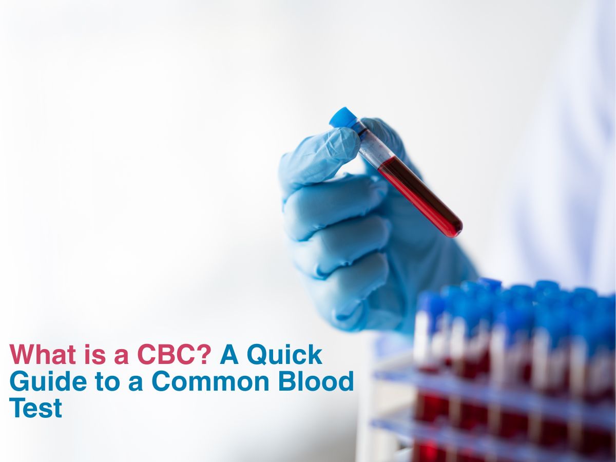 What is a CBC? A Quick Guide to a Common Blood Test