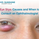 Eye Stye: Causes and When to Consult an Ophthalmologist