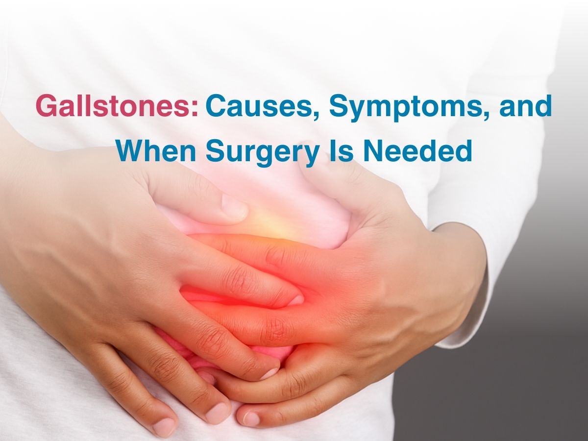Aug-Gallstones_ Causes, Symptoms, and When Surgery Is Needed
