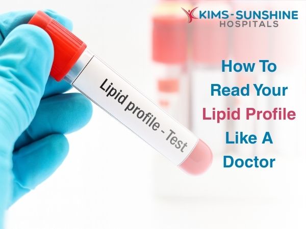 Aug-How To Read Your Lipid Profile Like A Doctor