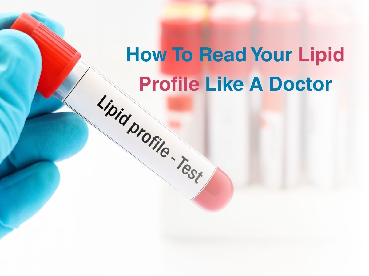 Aug-How To Read Your Lipid Profile Like A Doctor