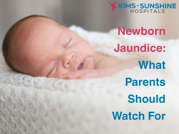 Aug-Newborn Jaundice_ What Parents Should Watch For