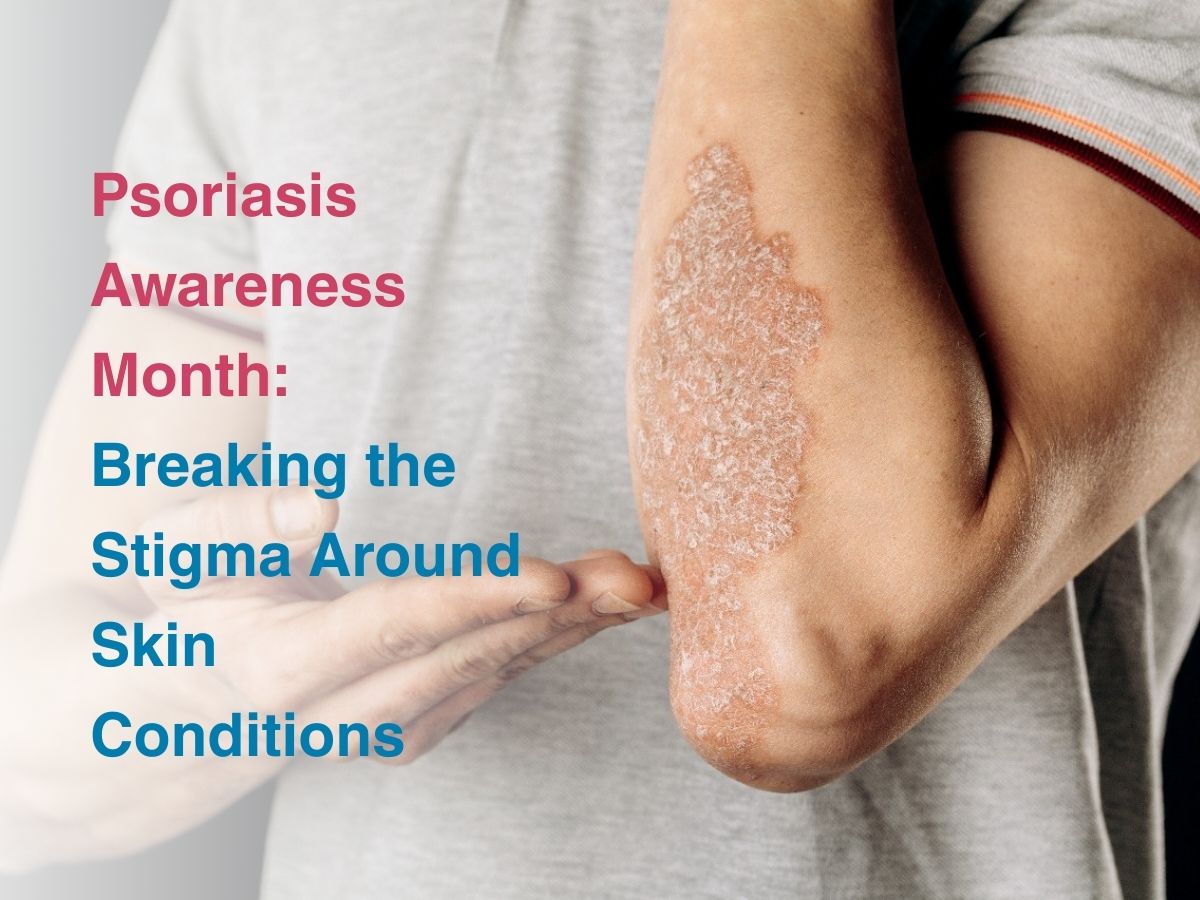 Psoriasis Awareness Month: Breaking the Stigma Around Skin Conditions