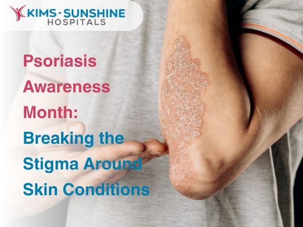 Psoriasis Awareness Month: Breaking the Stigma Around Skin Conditions