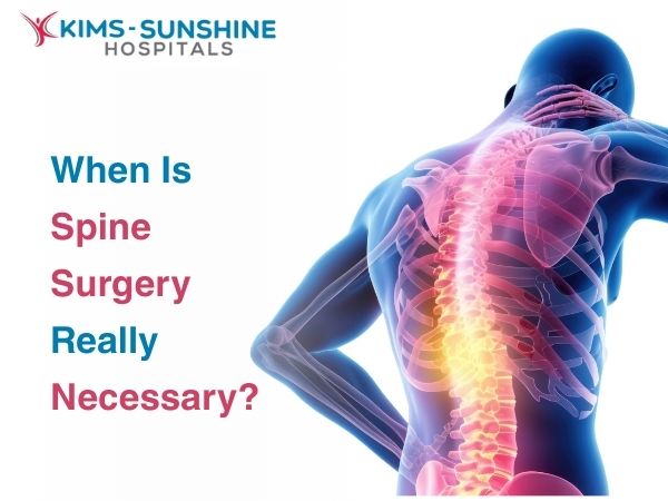 When Is Spine Surgery Really Necessary?
