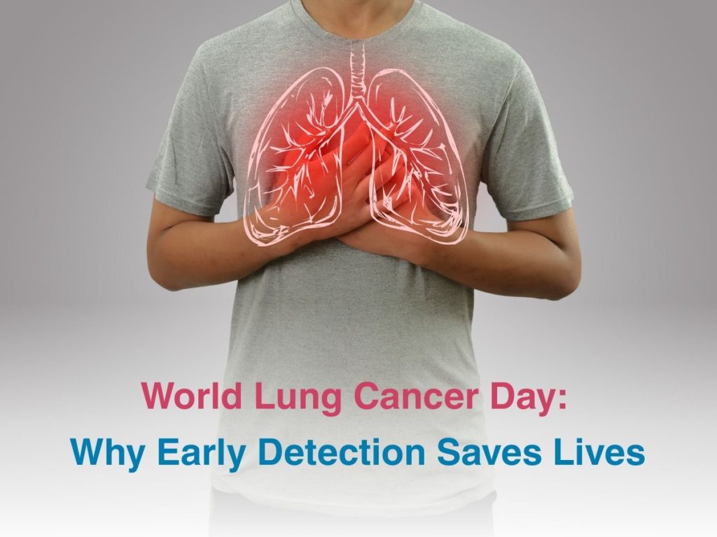 World Lung Cancer Day: Why Early Detection Saves Lives ...