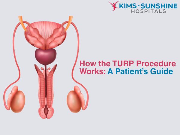 How the TURP Procedure Works: A Patient’s Guide