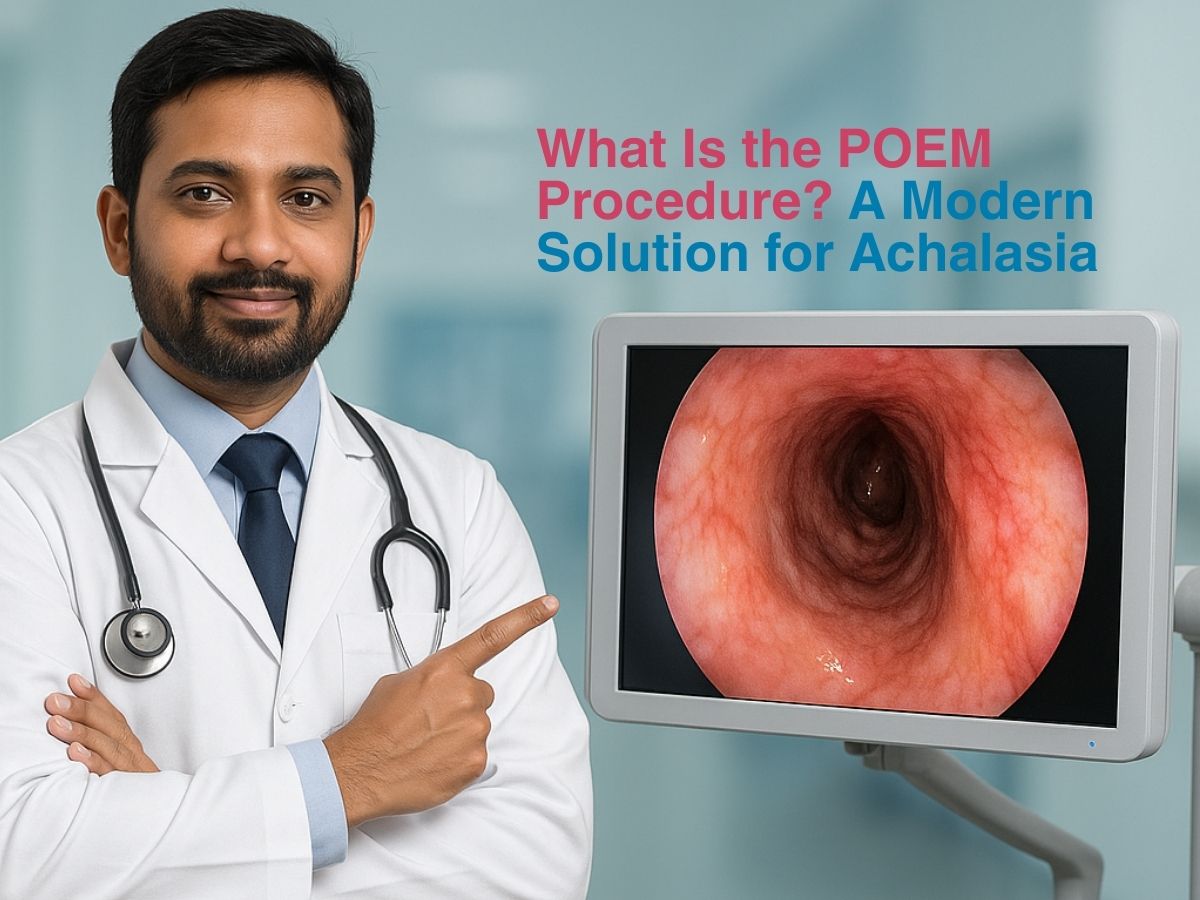 What Is the POEM Procedure? A Modern Solution for Achalasia
