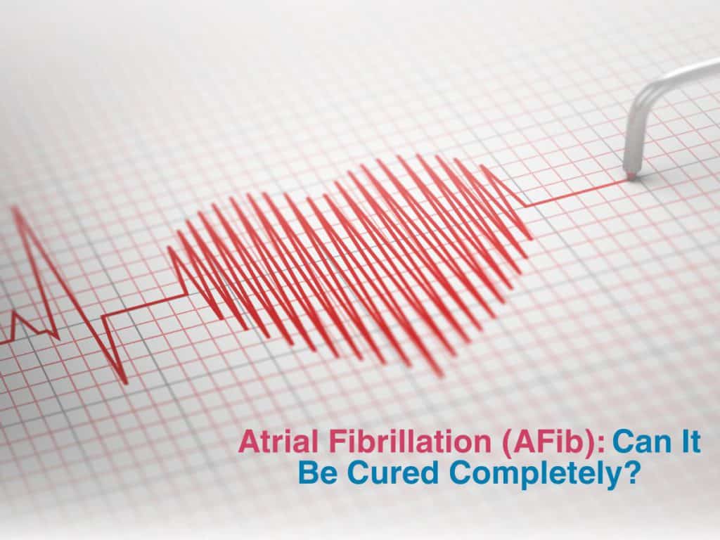 Atrial Fibrillation (AFib): Can It Be Cured Completely ...