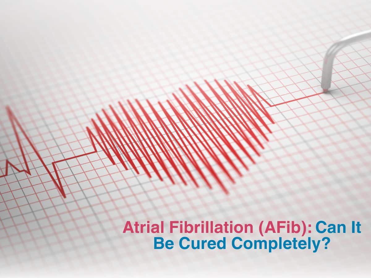 June -Atrial Fibrillation (AFib)_ Can It Be Cured Completely