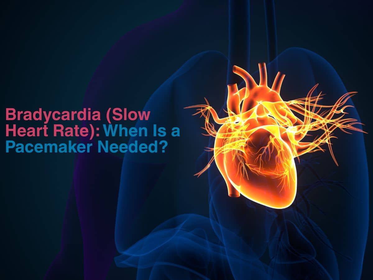 June -Bradycardia (Slow Heart Rate)_ When Is a Pacemaker Needed