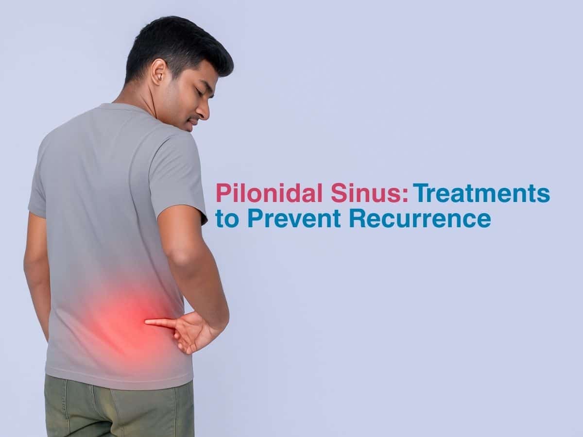 Pilonidal Sinus: Treatments to Prevent Recurrence
