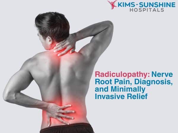 Radiculopathy: Nerve Root Pain, Diagnosis, and Minimally Invasive Relief