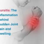 Oct-Bursitis_ The Inflammation Behind Sudden Joint Pain and Swelling