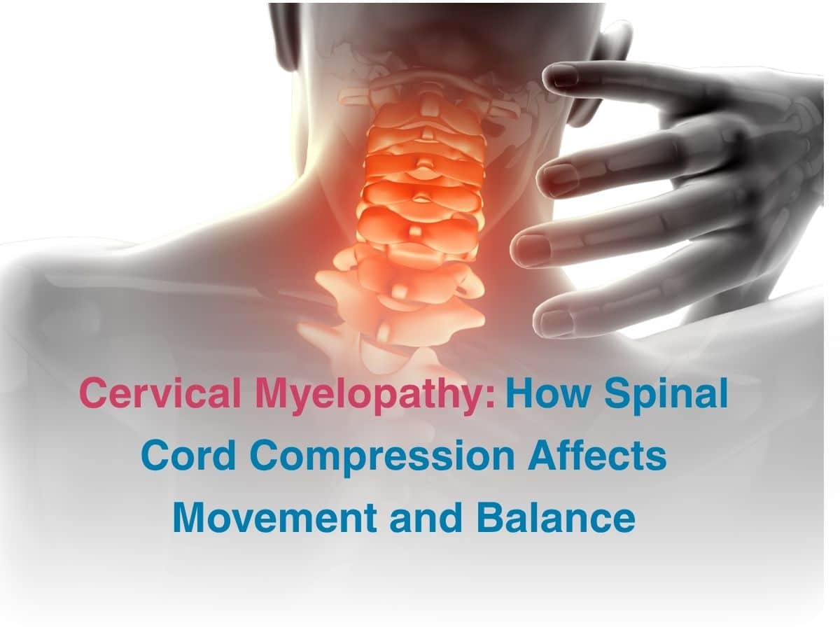 Oct-Cervical Myelopathy_ How Spinal Cord Compression Affects Movement and Balance
