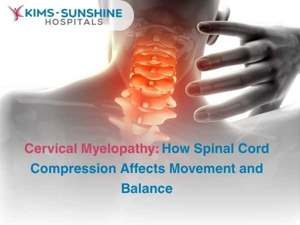 Oct-Cervical Myelopathy_ How Spinal Cord Compression Affects Movement and Balance