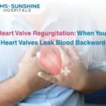 Oct-Heart Valve Regurgitation_ When Your Heart Valves Leak Blood Backward