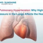 Oct-Pulmonary Hypertension_ Why High Pressure in the Lungs Affects the Heart