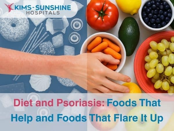Diet and Psoriasis_ Foods That Help and Foods That Flare It Up