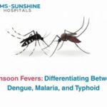 Monsoon Fevers: Differentiating Between Dengue, Malaria, and Typhoid
