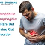 Eosinophilic Esophagitis: A Rare But Rising Gut Disorder
