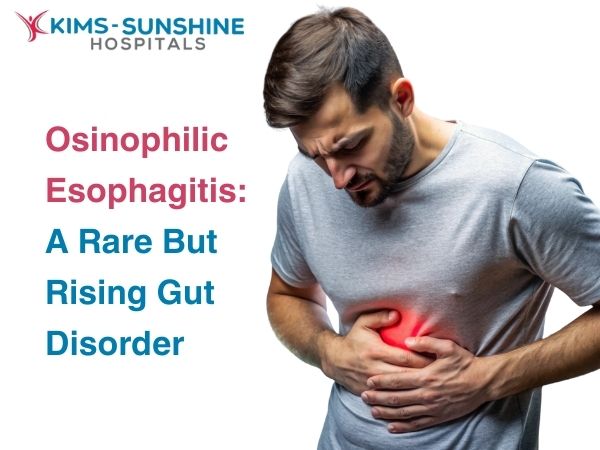 Eosinophilic Esophagitis: A Rare But Rising Gut Disorder