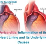 Pericarditis: Inflammation of the Heart Lining and Its Underlying Causes