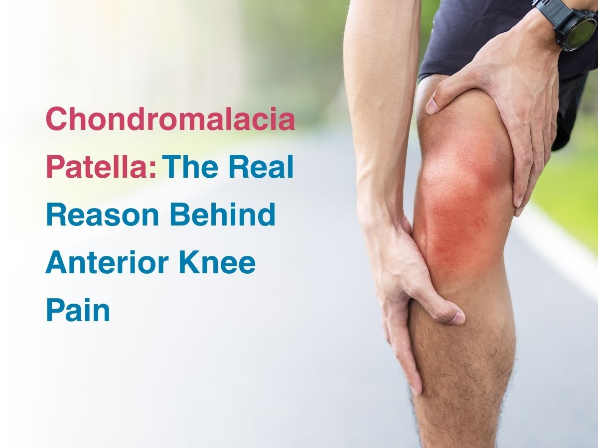 Nov-Chondromalacia Patella_ The Real Reason Behind Anterior Knee Pain - Multispeciality Hospital Chondromalacia Patella: The Real Reason Behind Anterior Knee Pain