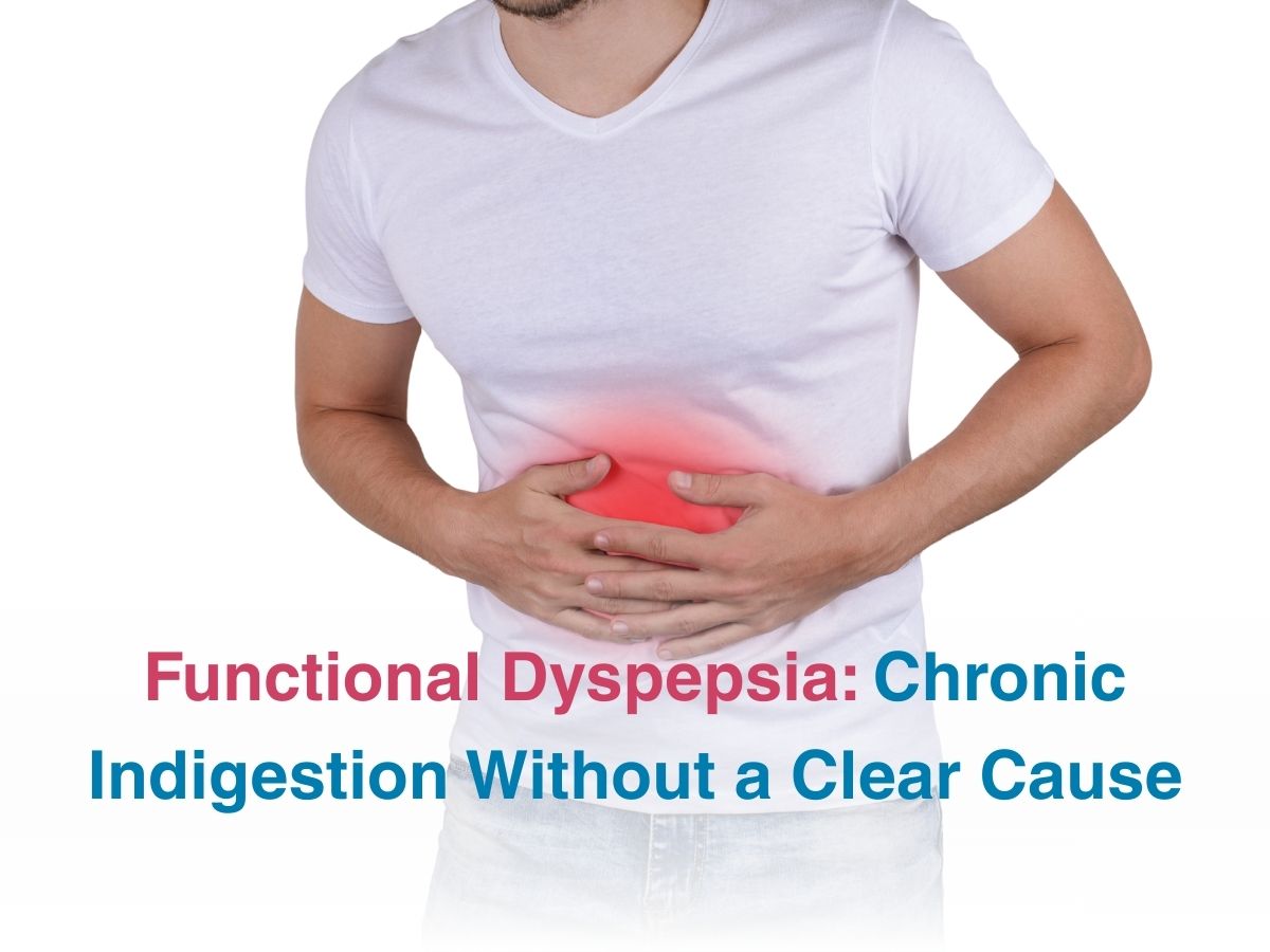Functional Dyspepsia: Chronic Indigestion Without a Clear Cause