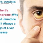 Gilbert’s Syndrome: Why Mild Jaundice Isn’t Always a Sign of Liver Disease