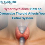 Hyperthyroidism: How an Overactive Thyroid Affects Your Entire System