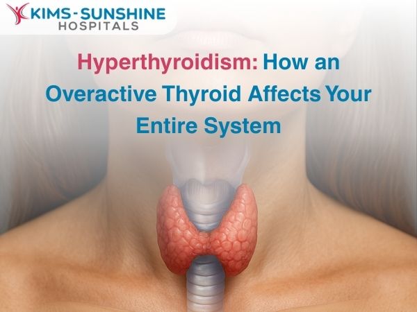 Hyperthyroidism: How an Overactive Thyroid Affects Your Entire System