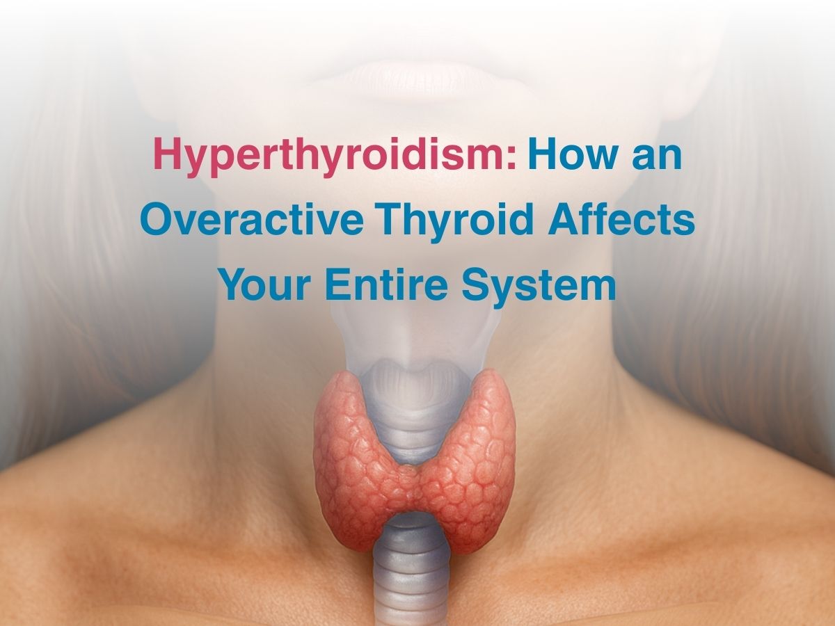 Nov-Hyperthyroidism_ How an Overactive Thyroid Affects Your Entire System - Multispeciality Hospital Hyperthyroidism: How an Overactive Thyroid Affects Your Entire System