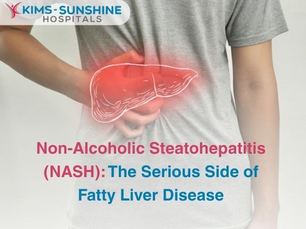 Non-Alcoholic Steatohepatitis (NASH): The Serious Side of Fatty Liver Disease
