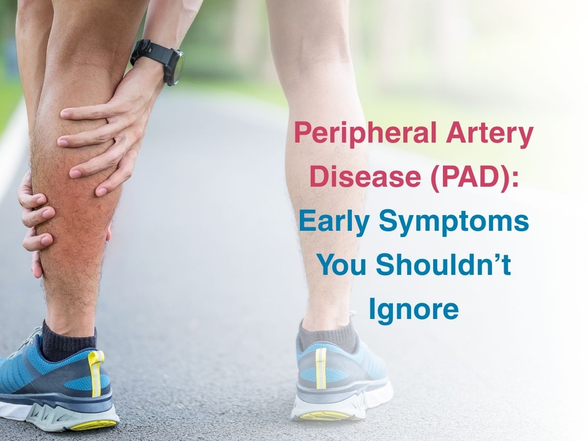 Peripheral Artery Disease (PAD): Early Symptoms You Shouldn’t Ignore