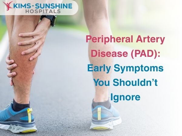 Peripheral Artery Disease (PAD): Early Symptoms You Shouldn’t Ignore