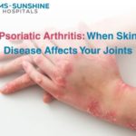Psoriatic Arthritis: When Skin Disease Affects Your Joints