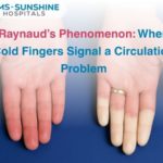 Raynaud’s Phenomenon: When Cold Fingers Signal a Circulation Problem