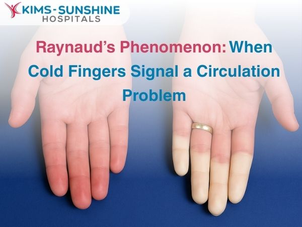 Raynaud’s Phenomenon: When Cold Fingers Signal a Circulation Problem