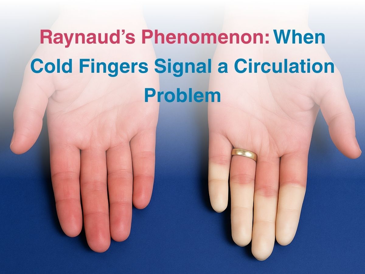 Raynaud’s Phenomenon: When Cold Fingers Signal a Circulation Problem