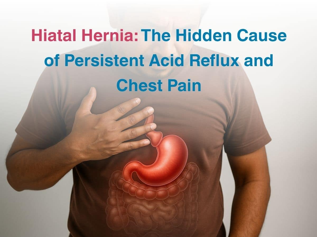 Oct-Hiatal Hernia_ The Hidden Cause of Persistent Acid Reflux and Chest Pain