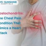 Costochondritis: The Chest Pain Condition That Mimics a Heart Attack